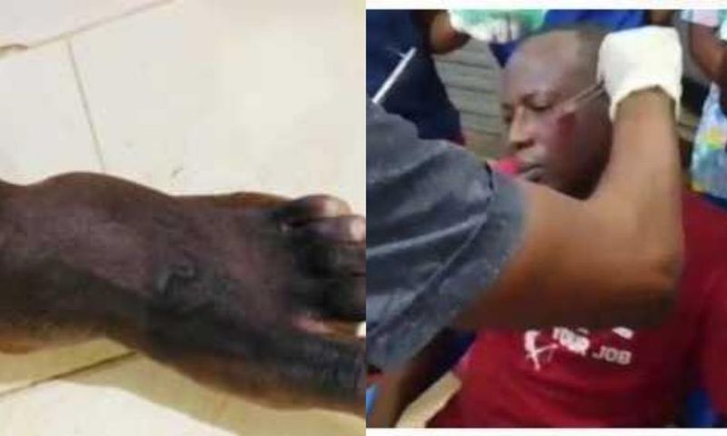 Armed robbers attack University of Ghana professor, 2 police officers injured