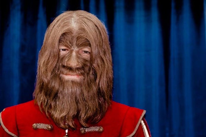 Werewolf syndrome [VocalMedia]