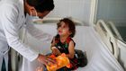 A nurse comforts a girl infected with diphtheria at the al-Sabeen hospital in Sanaa, Yemen October 21, 2018.