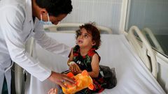 A nurse comforts a girl infected with diphtheria at the al-Sabeen hospital in Sanaa, Yemen October 21, 2018.
