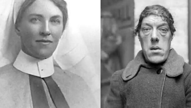 Mary Ann Bevan suffered from acromegaly which changed her appearance [Twitter/@dataCurioso73/Wikipedia]