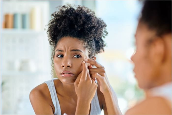 Let's debunk some acne myths [Allure]