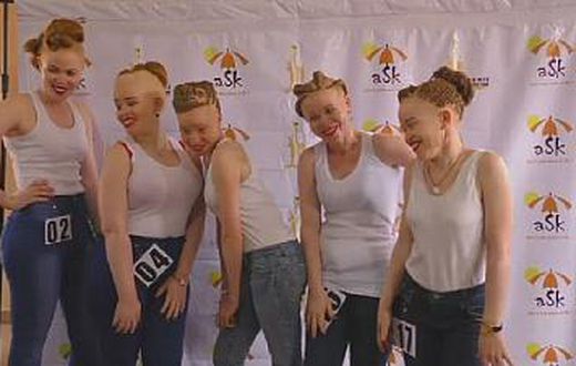 Albinos contestants in Uganda