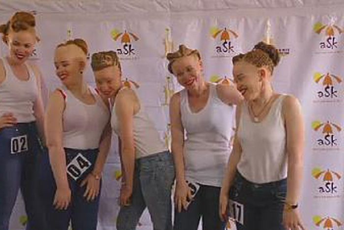 Albinos contestants in Uganda