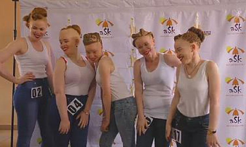 Albinos contestants in Uganda