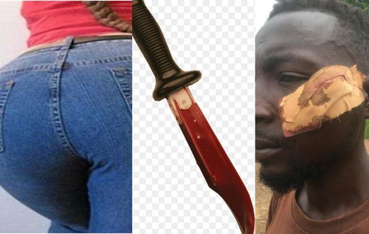7 Ghanaian men severely injured after bloody machete fight at wake-keeping over woman