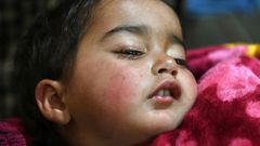 Hiba Jan was hit by a pellet fired from a pump-action gun in Kashmir