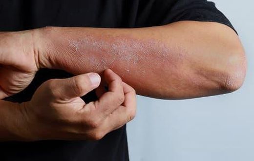 Scaly skin on face derma [Derma Essentia]
