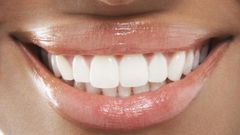 Woman with white teeth