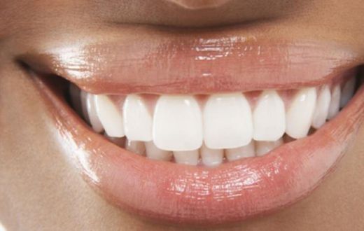 Woman with white teeth