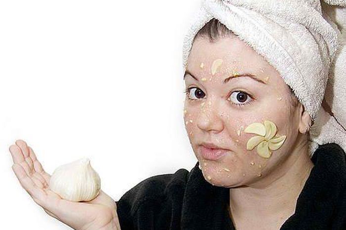 Treating acne with garlic