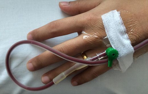 A stock image of a person receiving a blood transfusion. People with hemophilia B receive regular infusions of clotting factor IX to treat their condition.