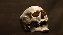 Man finds human skull in front of his house