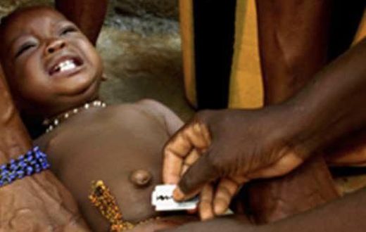 Circumcision