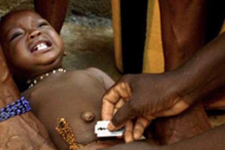 Circumcision