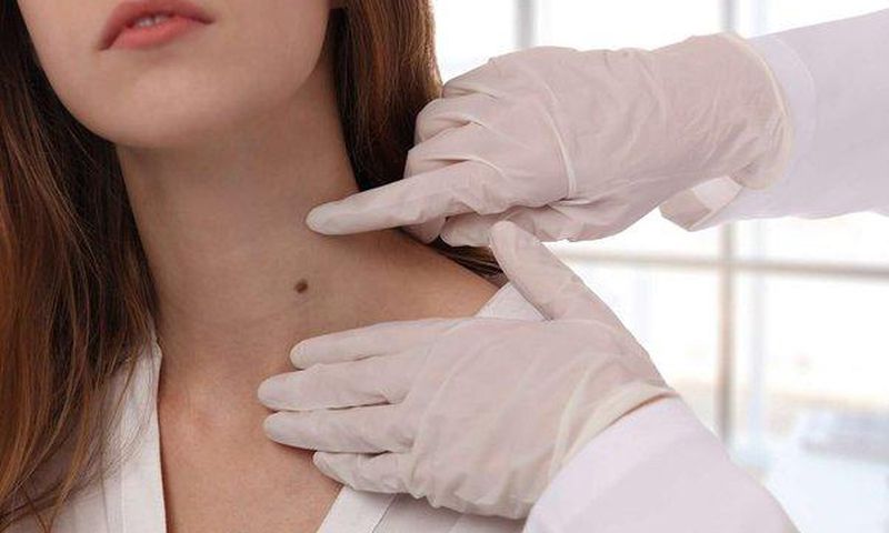 What do birthmarks mean [Children'sSkinCentre]