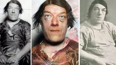 Mary Ann Bevan won an 'ugliest woman in the world' competition [Fact Issues]