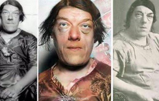 Mary Ann Bevan won an 'ugliest woman in the world' competition [Fact Issues]
