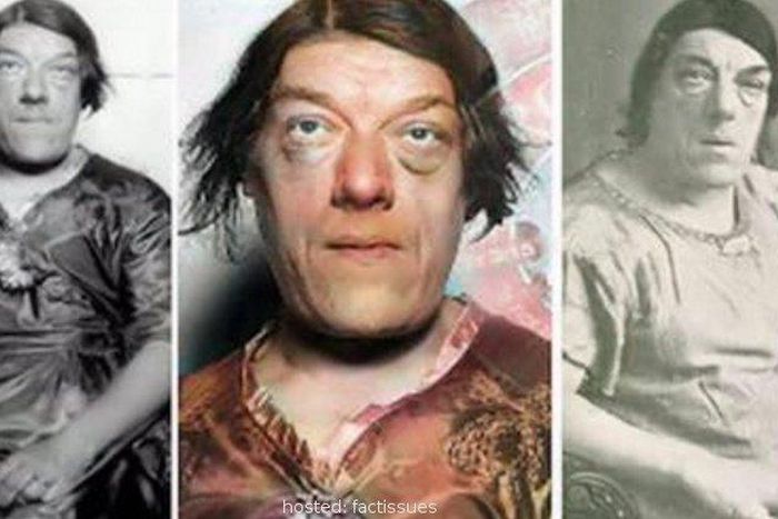 Mary Ann Bevan won an 'ugliest woman in the world' competition [Fact Issues]