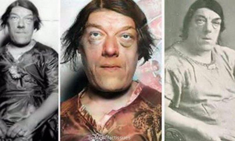 Mary Ann Bevan won an 'ugliest woman in the world' competition [Fact Issues]