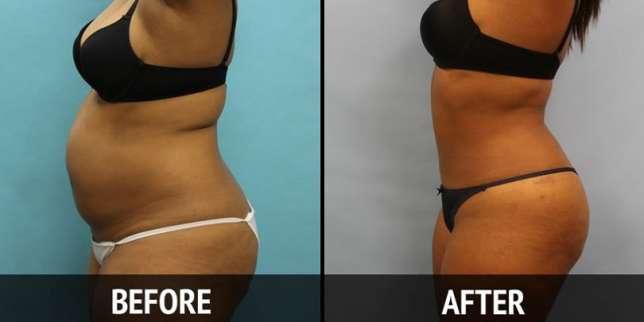 FDA pounces on unauthorised breast, hip enlargement products