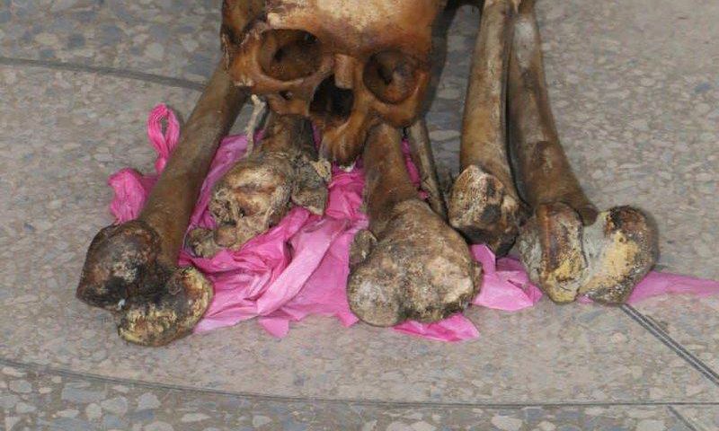human skull