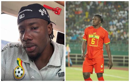 Mohammed Salisu shows his bruised face from battling win against Mali
