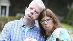 Couple who cannot smile because of a rare disease fall in love