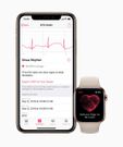 Apple Watch Series 4 Heart Rate Notifications with iPhone Xs