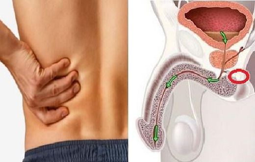 5 early symptoms of cancer in men