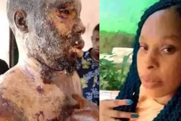 Wife arrested for pouring hot groundnut oil on husband