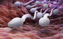 sperme-spermatozoides