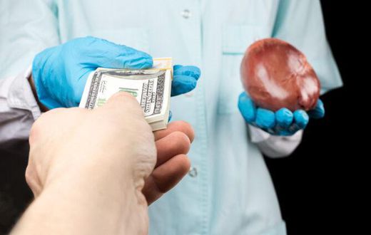 Organ harvesting
