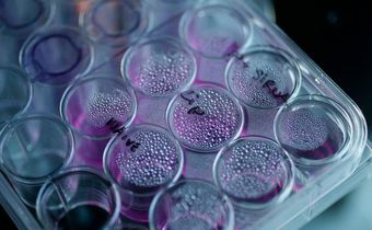 cancer cells