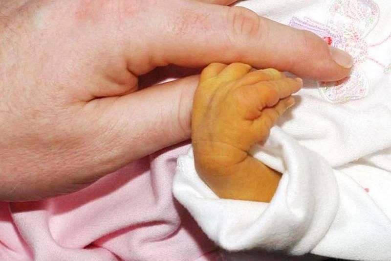 Jaundice photo [Intermountain Healthcare]