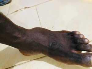 Armed robbers attack University of Ghana professor, 2 police officers injured