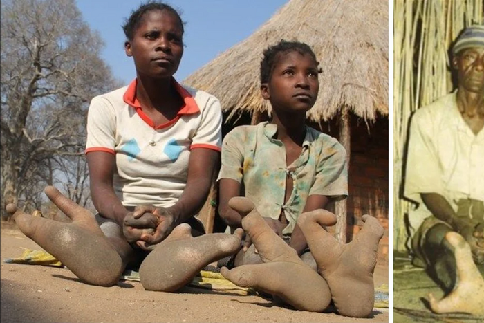 They are also called the ostrich tribe of Zimbabwe [EarthlyMission]