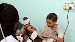 7 heartbreaking images show why US lawmakers want to stop supporting the brutal Saudi-led war in Yemen that's seen indiscriminate attacks and left millions at the brink of famine