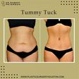 Why does the tummy accumulate fat? [Pinterest]