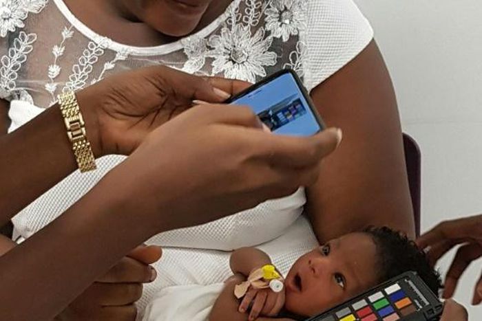 A baby is screened during a trial in a large-scale feasibility study using a smartphone-based screening for jaundice at Greater Accra Regional Hospital in Accra, Ghana in this undated handout photo from the University of Ghana