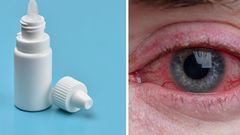 Signs of an eye infection include redness and pain.Getty Images