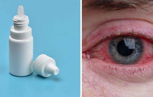 Signs of an eye infection include redness and pain.Getty Images