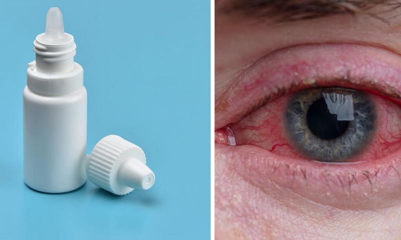 Signs of an eye infection include redness and pain.Getty Images
