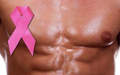 Men get breast cancer too [NewsamMedicine]