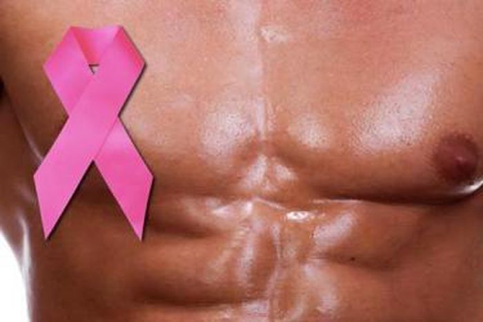 Men get breast cancer too [NewsamMedicine]