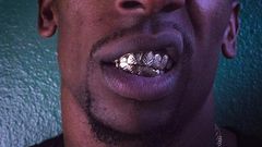 Man, 22, lands in hospital as silver grillz worn to decorate teeth gets stuck in his lungs