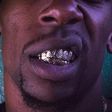 Man, 22, lands in hospital as silver grillz worn to decorate teeth gets stuck in his lungs