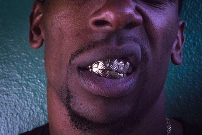 Man, 22, lands in hospital as silver grillz worn to decorate teeth gets stuck in his lungs