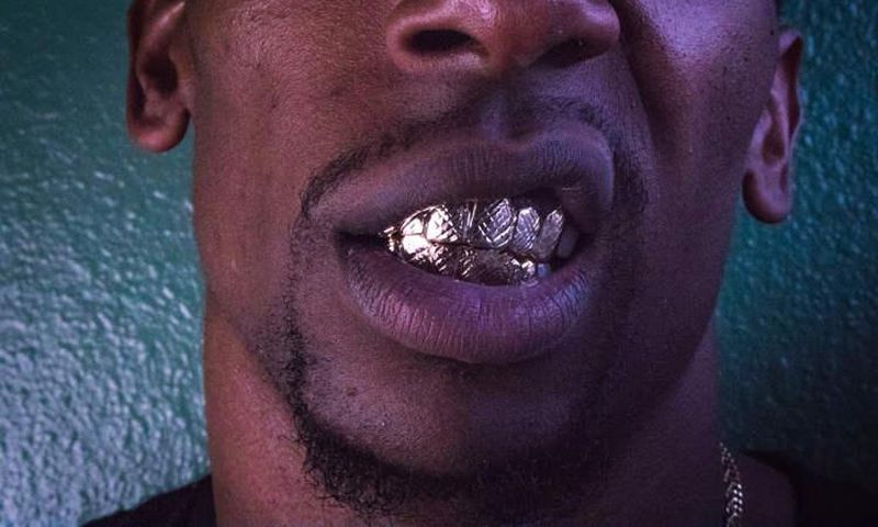 Man, 22, lands in hospital as silver grillz worn to decorate teeth gets stuck in his lungs