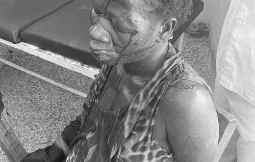Pregnant woman battles for life after being butchered by husband in Nchumuru